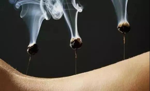 艾灸不是藥，調的不是病，央視為艾灸正名，讓我們正視艾灸