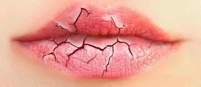 嘴唇干裂，或許不是缺水，嘴唇老是干艾灸什么穴位！