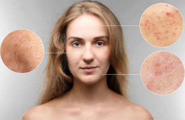 艾灸有美容效果嗎？艾灸哪里能美容