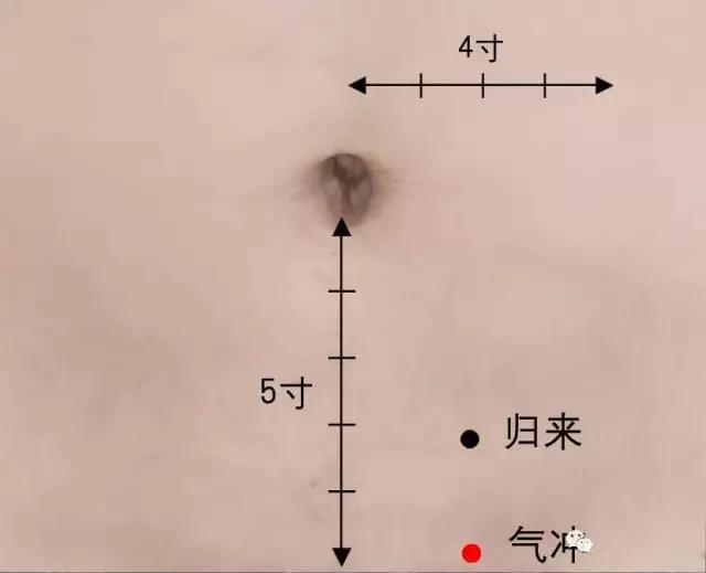 　一艾灸就上火，這是為什么?