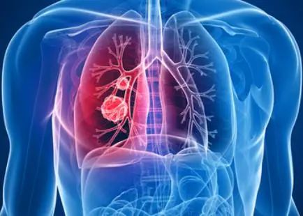 脾胃是健康的根，脾胃和口眼耳鼻、以及五臟的關(guān)聯(lián)全在這！