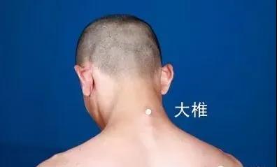 春天灸灸背，能活一百歲~