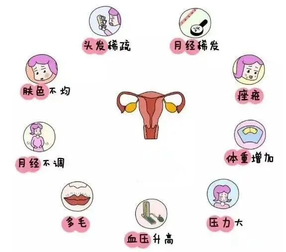 10個(gè)女人就有1個(gè)患多囊！被它纏上不要怕，艾灸幫你調“多囊”！